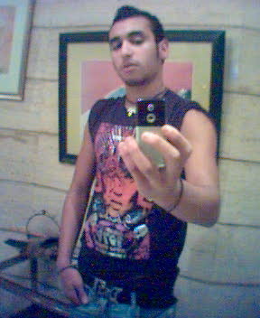 MR AcHbA